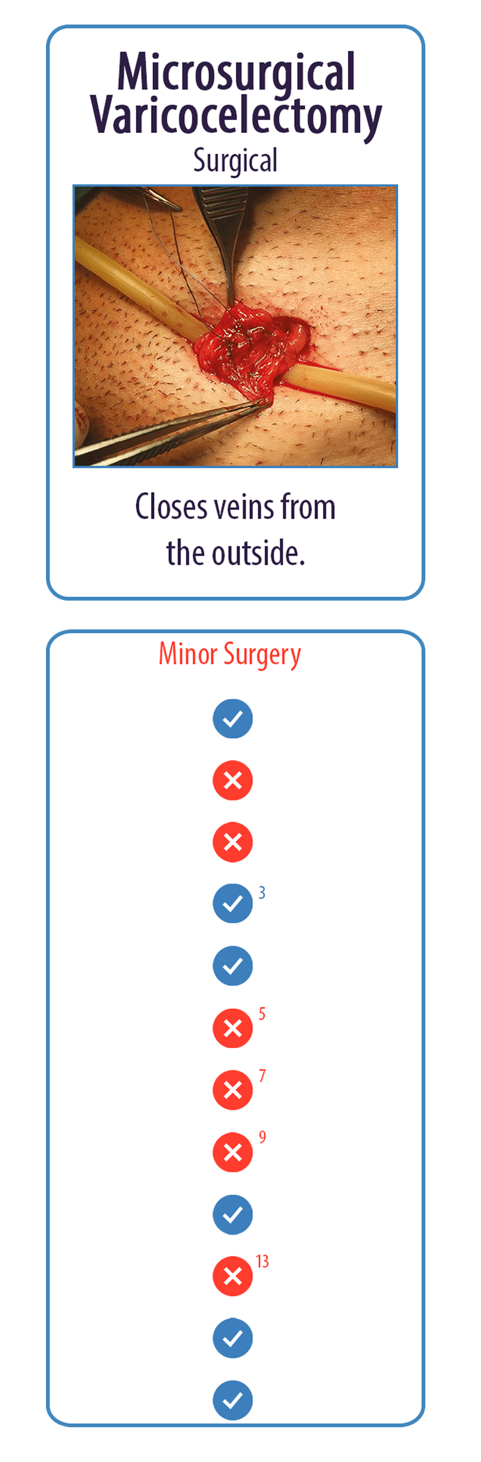 Microsurgical Varicocelectomy Surgical