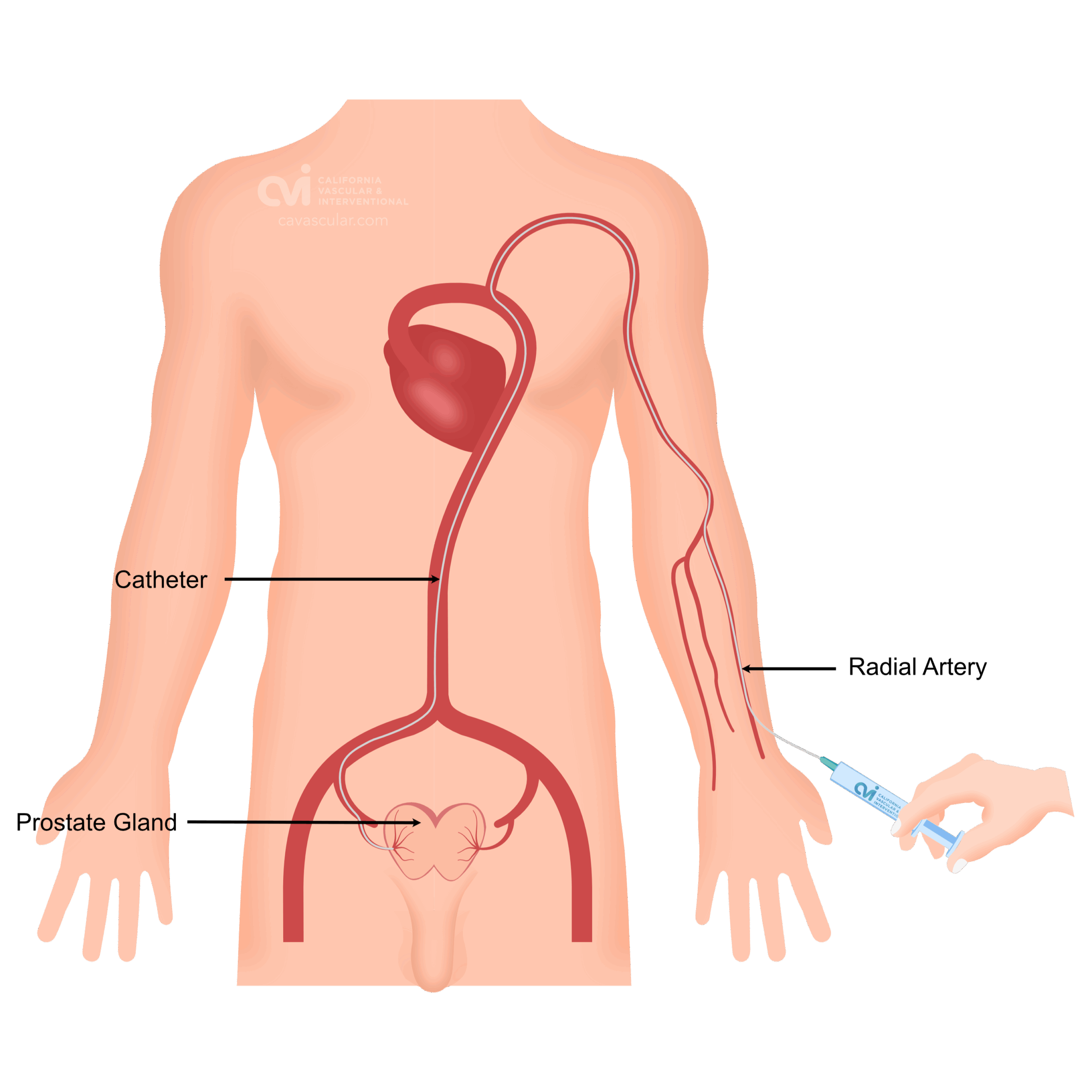 Prostate Gland 2