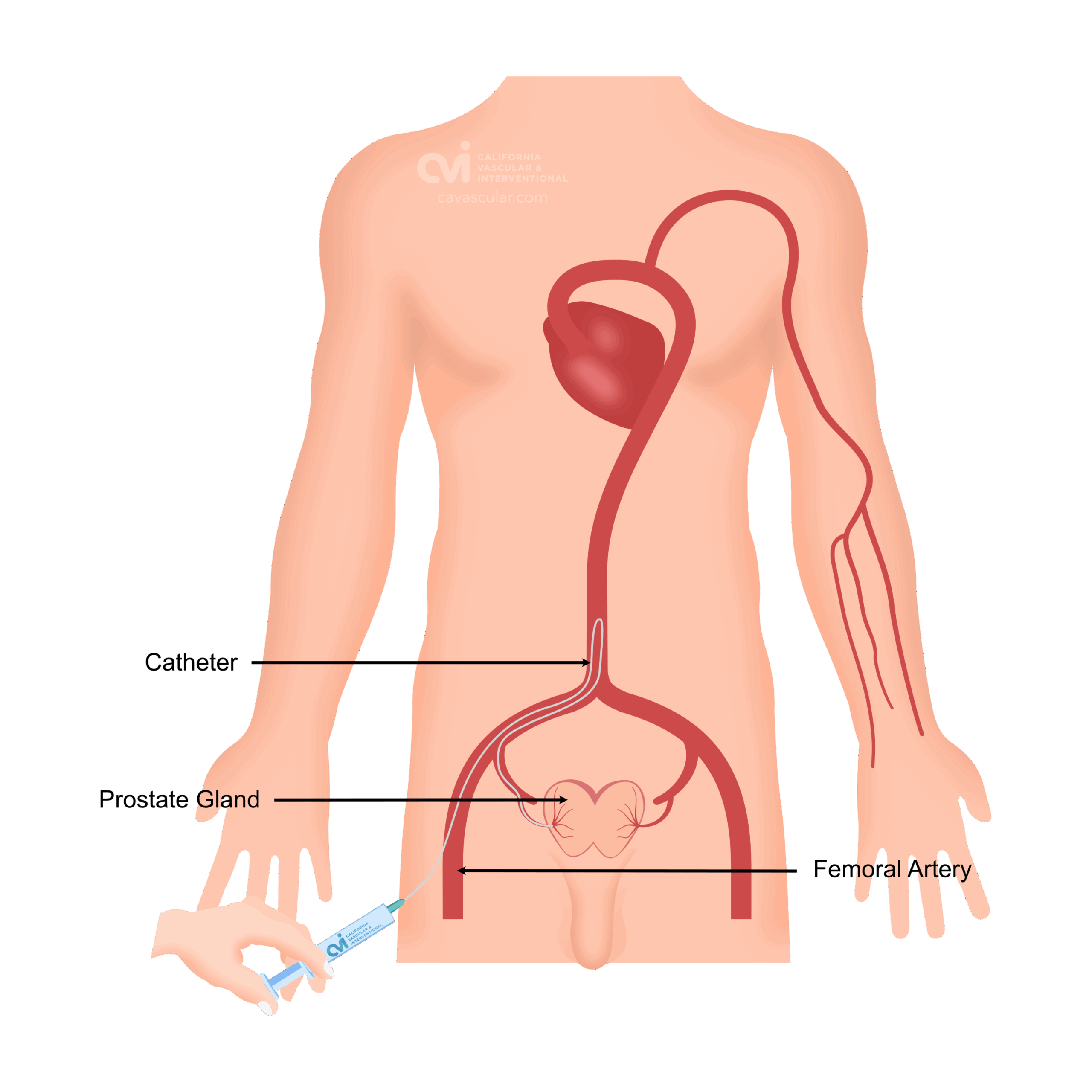 Prostate Gland